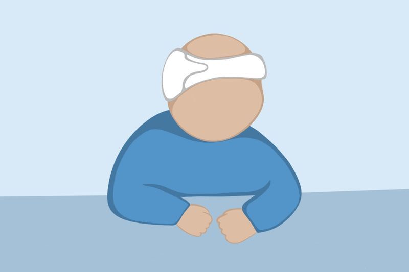 Brachycephaly: Treating – Flat Head Syndrome article image