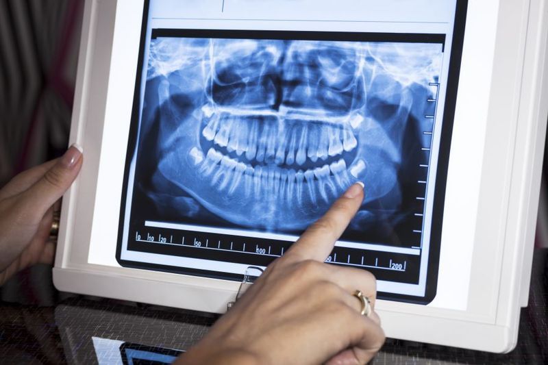 Can I get a Dental X-ray if i’m Pregnant? article image