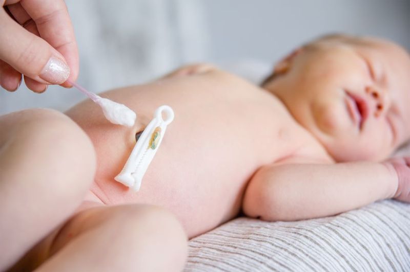 Caring for Your Baby’s Umbilical Cord article image