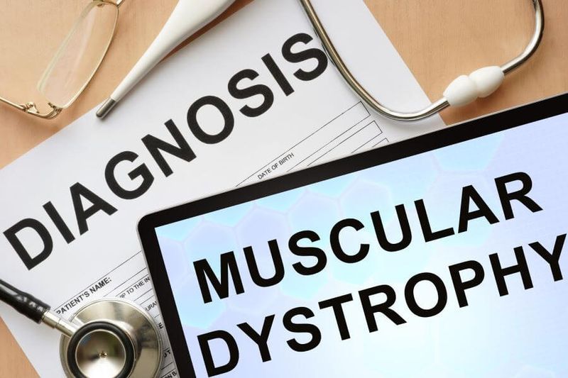 Diagnosis and Treatment of Muscular Dystrophy article image