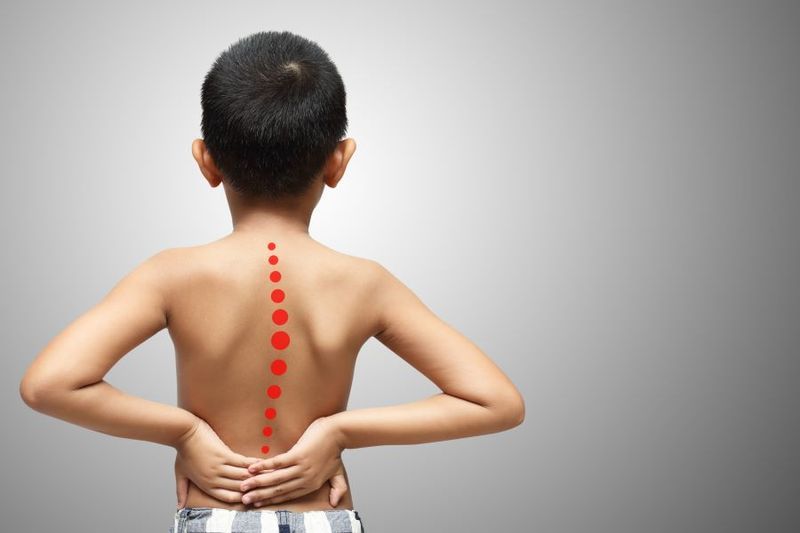 Does Your Child Have Scoliosis? Recognize the Signs article image