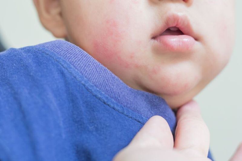 How do I Know if my Baby is Allergic to a Food? article image