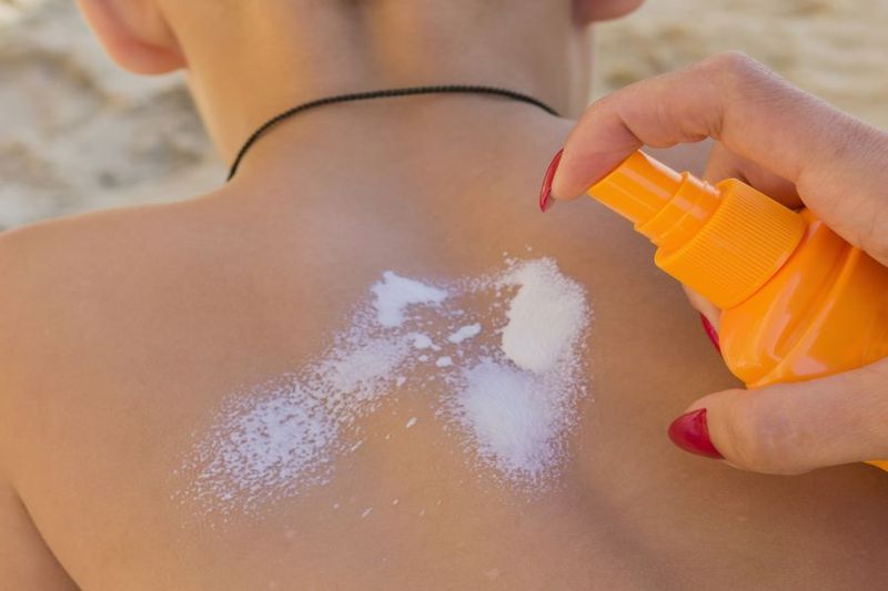 How to Treat Sunburns in Children article image