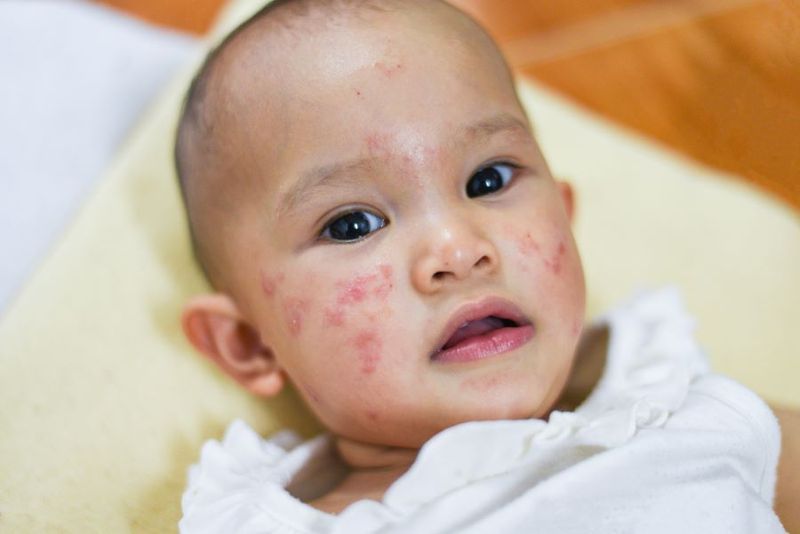 Q&a With Dr. Sara Connolly: Food Allergies in Your 11-month-old article image