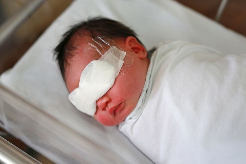 Retinopathy in Premature Infants article image