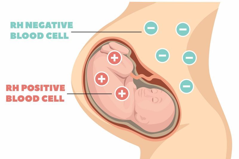 What is Rhesus Disease? article image