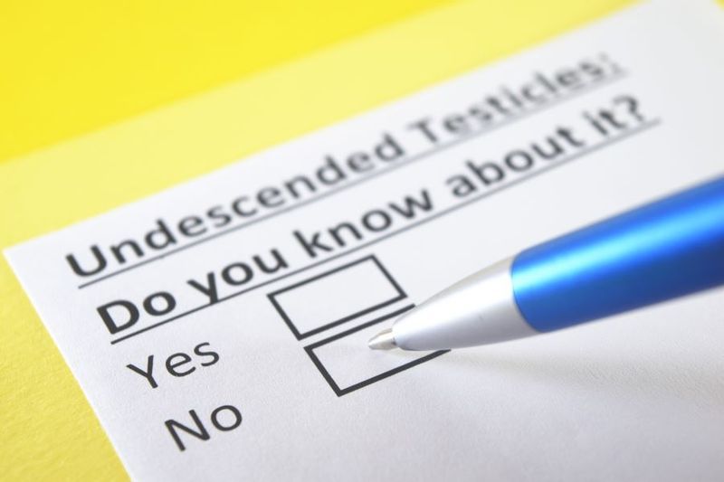 Undescended Testicles article image