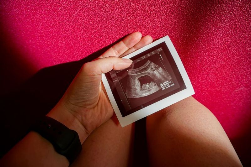 Week-by-Week Pregnancy (Weeks 1-13) article image
