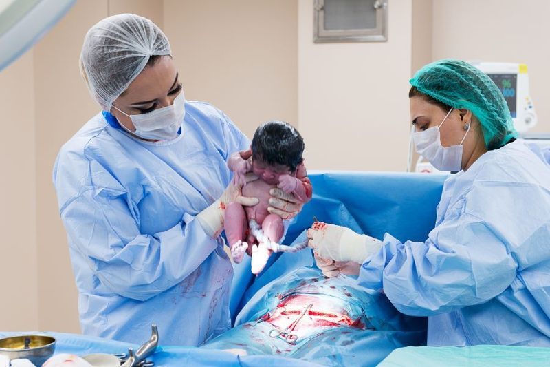What Happens During an Emergency C-section? article image