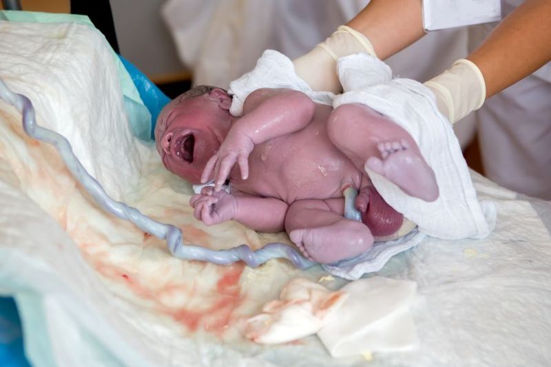 What is Delayed Cord Clamping, and Will it Help Your Newborn? article image