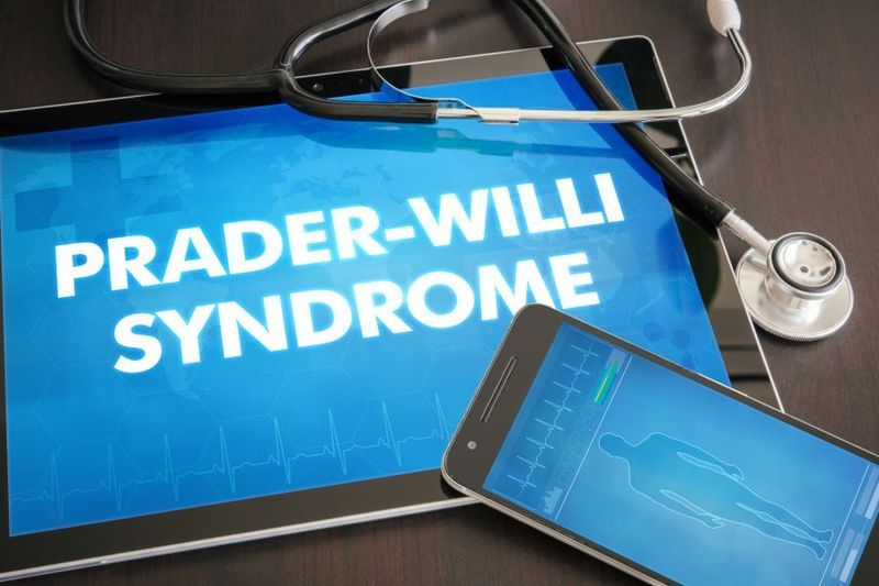 What is Prader-Willi Syndrome? article image