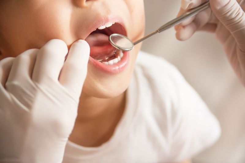 When Will My Child Start Losing Teeth? article image