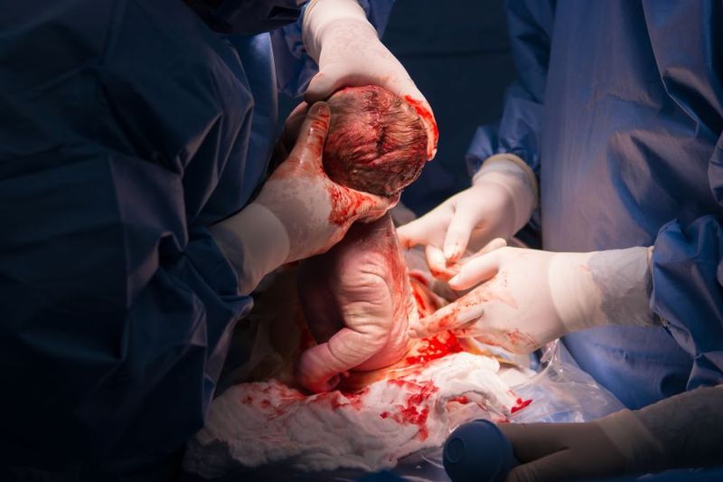 Why you Might Need a C-section if Your Baby is too big for Delivery article image